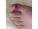 a169418-Big toe s.jpg